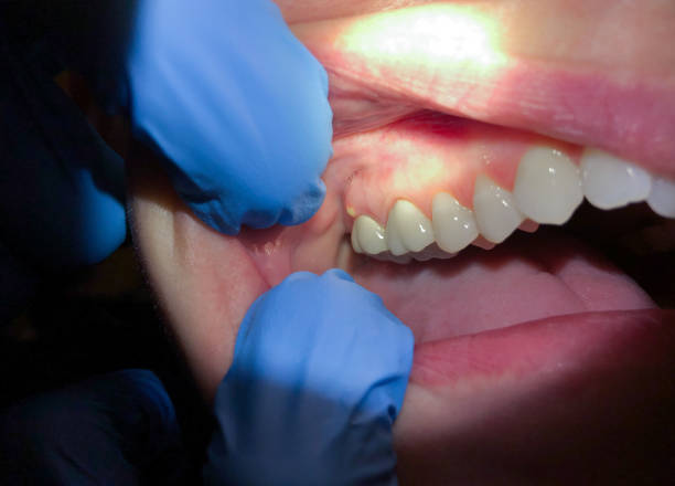 Best Pediatric Emergency Dentist in Clawson, MI