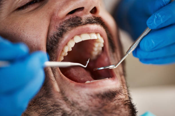 Best Emergency Tooth Extraction in Clawson, MI